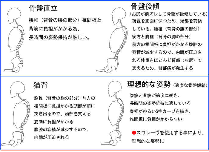 【骨盤直立】腰椎(背骨の腰の部分)椎間板と背筋に負担がかかる為、長時間の姿勢保持が厳しい。【骨盤後傾】(お尻が前ズレして骨盤が後傾している)視線を正面に保つため、頭部を前傾している。腰椎(背骨の腰の部分)後方と胸椎(背骨の胸の部分)前方の椎間板に負担がかかる。腹腔の容積が減少するので、内臓が圧迫される【理想的な姿勢】(適度な骨盤傾斜)腹筋と背筋が適度に働き、長時間の姿勢維持に適している
脊椎がゆるいS字カーブを描き、椎間板に負担がかからない。スワレーヴを使用する事により、理想的な姿勢に。